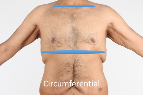 Circumferential image. Front facing image