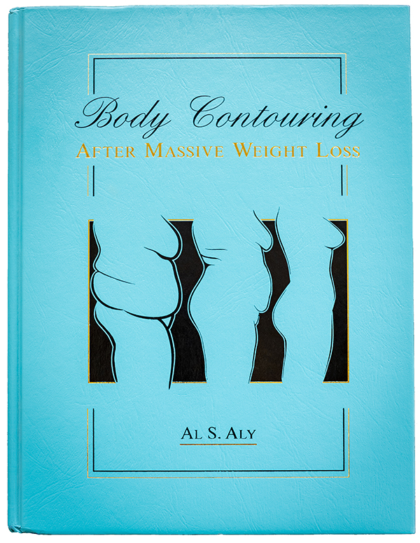 Body Contouring, After massive weight loss, by Dr. Al Aly, MD